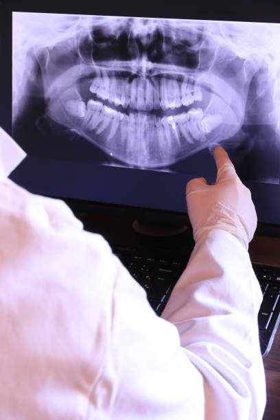 Best Pediatric Emergency Dentist in Broussard, LA