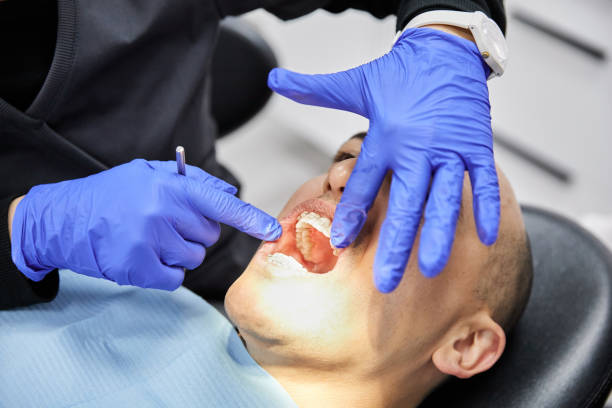 Best Emergency Root Canal Treatment in Broussard, LA
